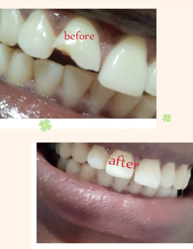 Treatment Result