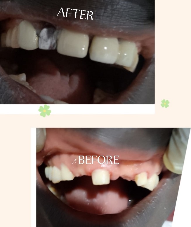 Treatment Result