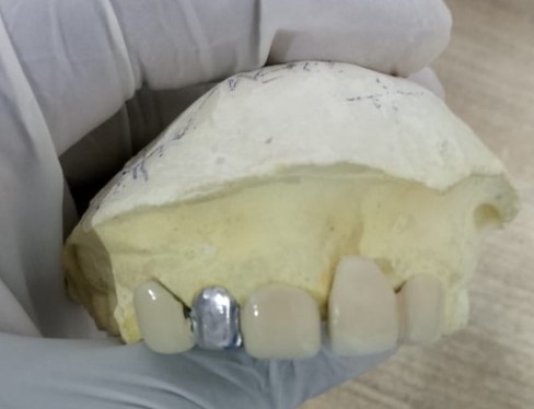 Treatment Result